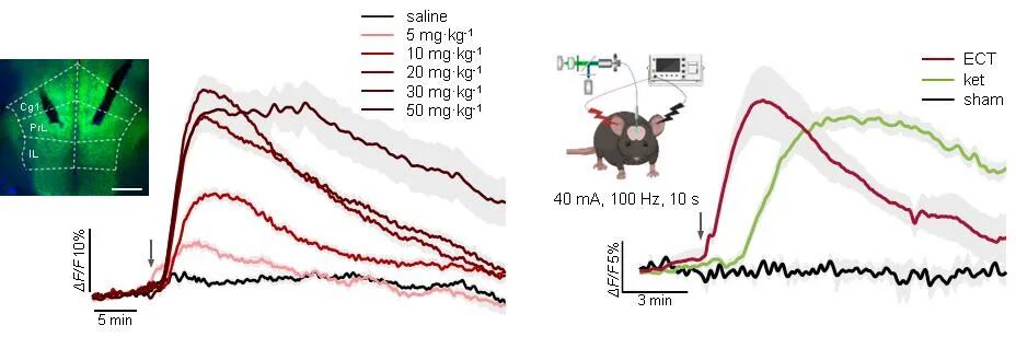 中国科学家找到抑郁症有效疗法“总开关”，正开发高效新药